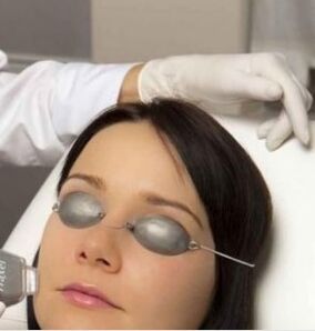 Field laser rejuvenation