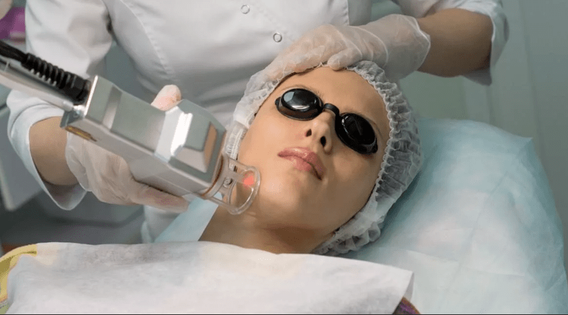 FLYYE PHOTOTERMOLISIS