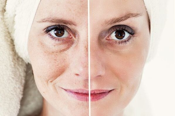 before and after