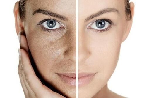 Make the skin with its own blood plasma