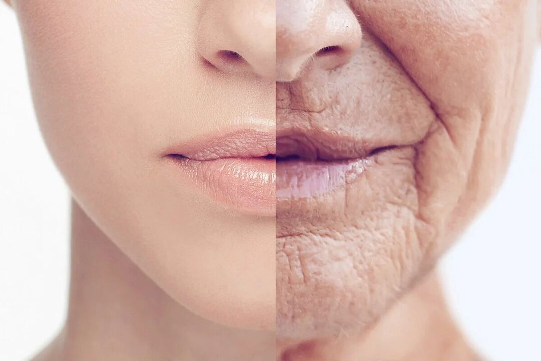 Skin deterioration with age.