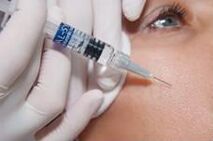 Biorevitalization procedure