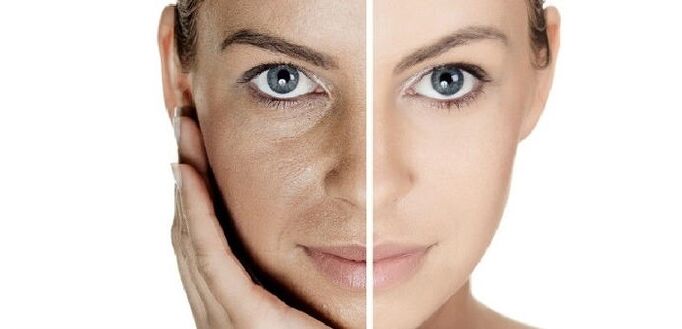 before and after facial skin rejuvenation