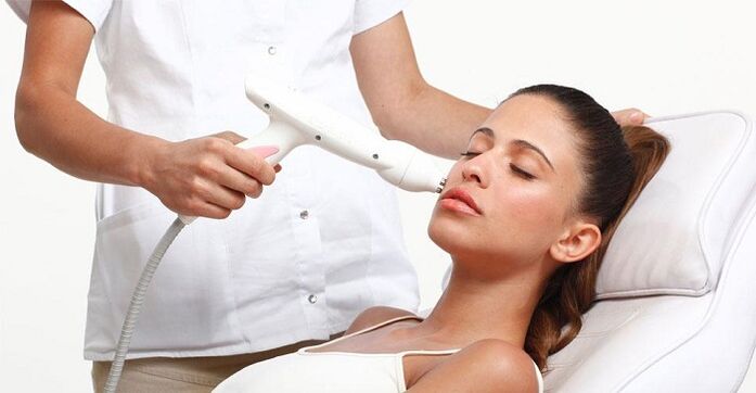 facial photorejuvenation procedure