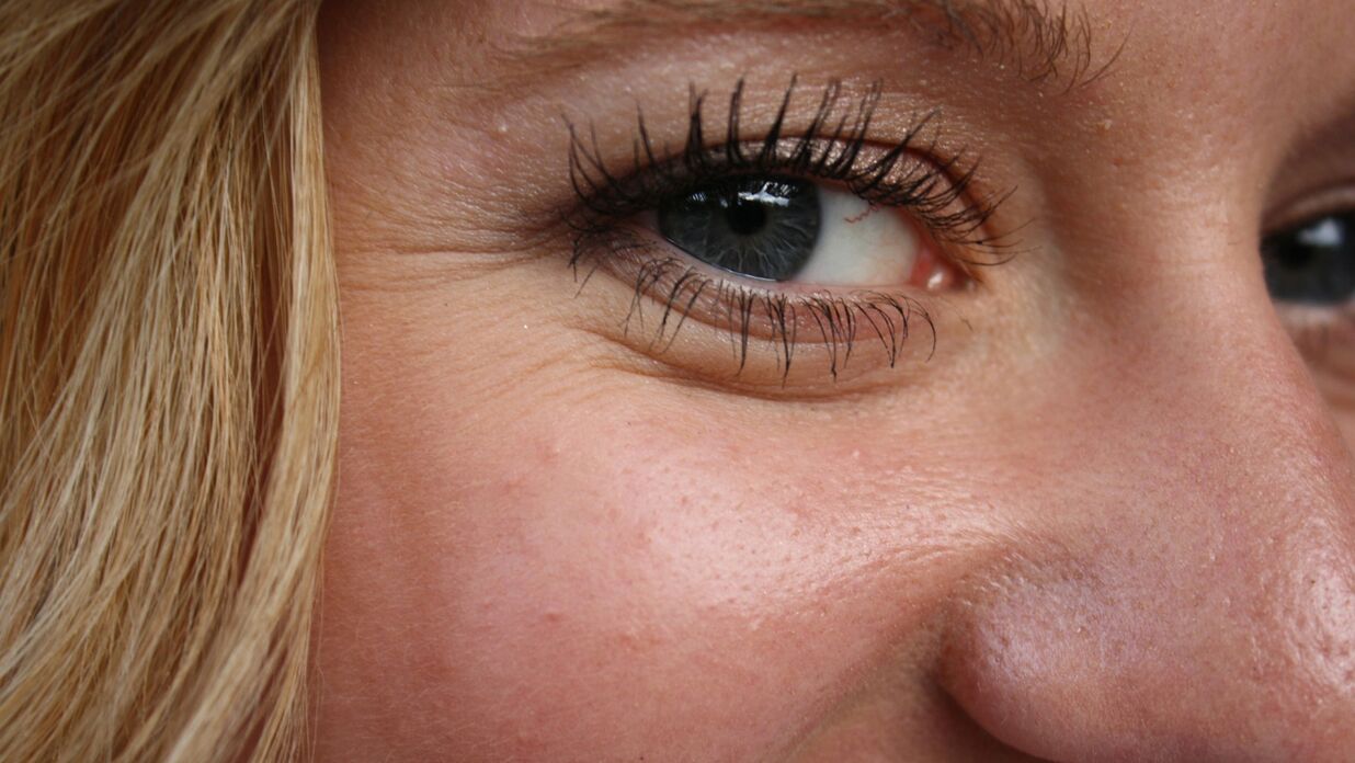 The appearance of wrinkles is a natural process.