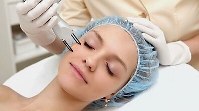 Fractional facial skin rejuvenation procedure.