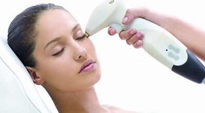 How is fractional skin resurfacing performed