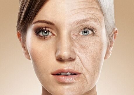 before and after laser facial skin resurfacing