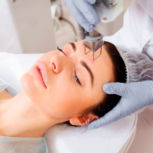Photothermolysis procedure for facial skin rejuvenation. 
