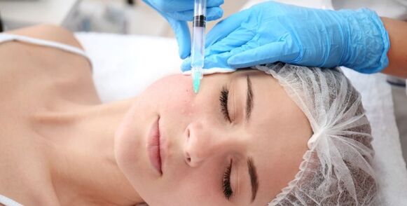 A cosmetologist performs a facial skin rejuvenation procedure with plasma. 